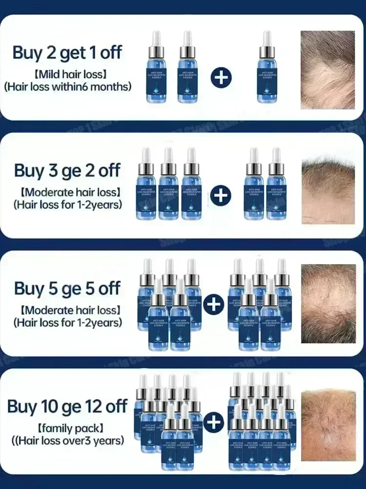 2 Hair growth and anti hair loss serum, anti hair loss scalp nutrition products
