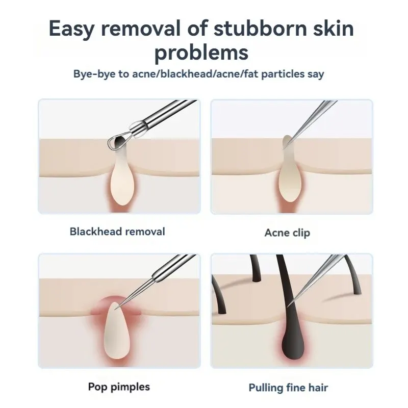 คีมหนีบสิวเสี้ยนทำจากสเตนเลสจำนวน7ชิ้นอุปกรณ์ลอกสิวสิวแหนบสีดำเข็มสำหรับร้านเสริมสวย