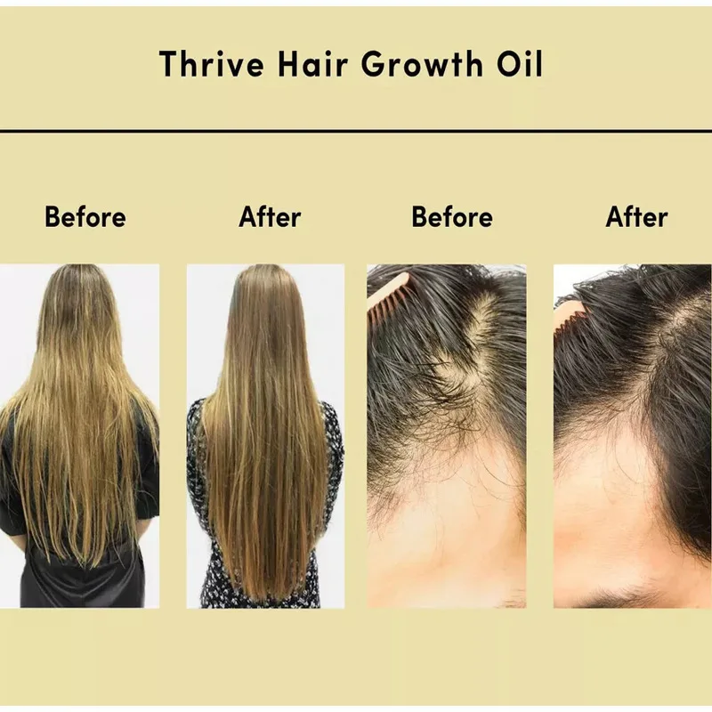 Natural Hair Growth Oil Veganic Castor Oil Promote Rapid Hair Growth Argan Oil To Encourage Fuller Hair Thickening For Hair