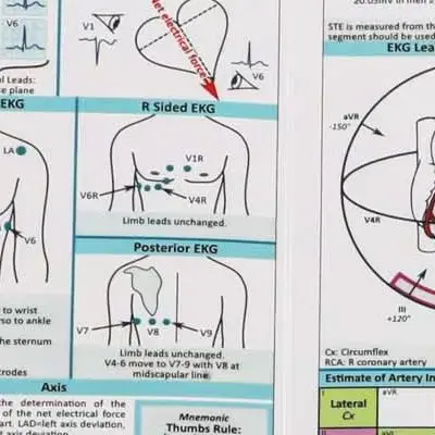 Horizontal And Vertical Layout Pocket Card For ECG Interpretation Guide With ACLS Analysis Reference Tool For Pro