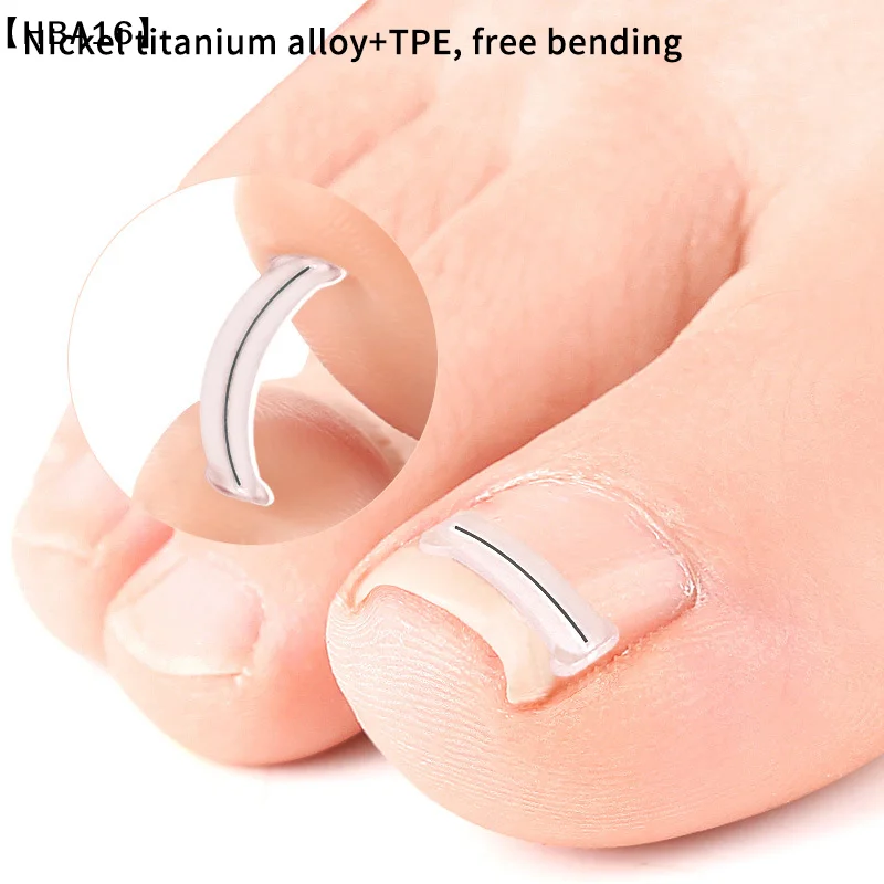 ómHBA16 Parque2 Stuks Nagel Correctie Stickers Ingegroeide Teennagel Corrector Patches Paronychia Behandeling Herstellen Corrector Pedicure Gereedschap