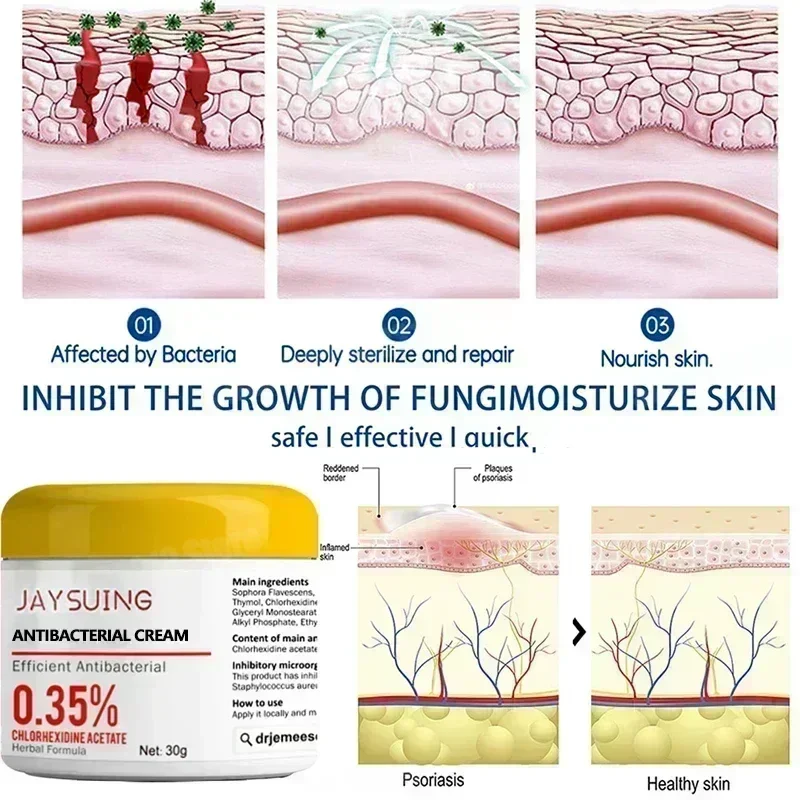 Рисунок 3 - Сверхсиловой крем от псориаза для