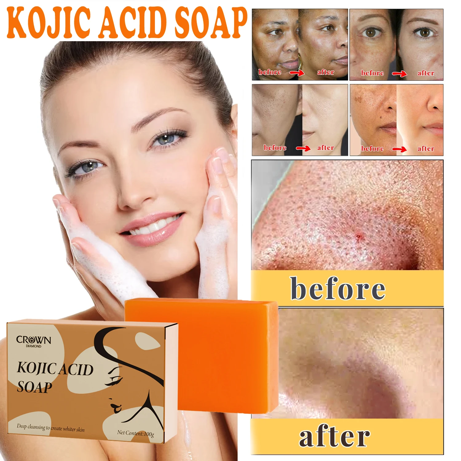 

Original Kojic Acid Soap Glow Recipe Turmeric for Cleaning The Face & Body Oil Control Whitening Make Brighten for Face Wash