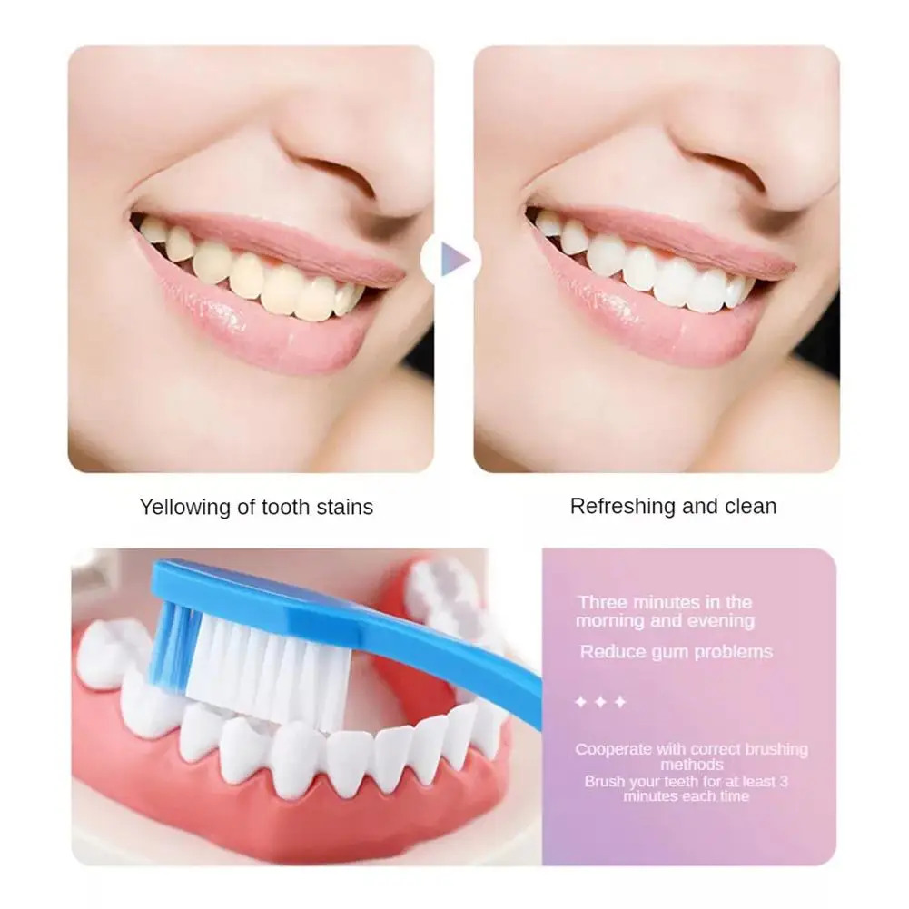 1/2/4PCS Niacinamide Toothpaste to Remove Tobacco and Yellow Dental Stain Fresh Breath Oral Care Teeth Whitening