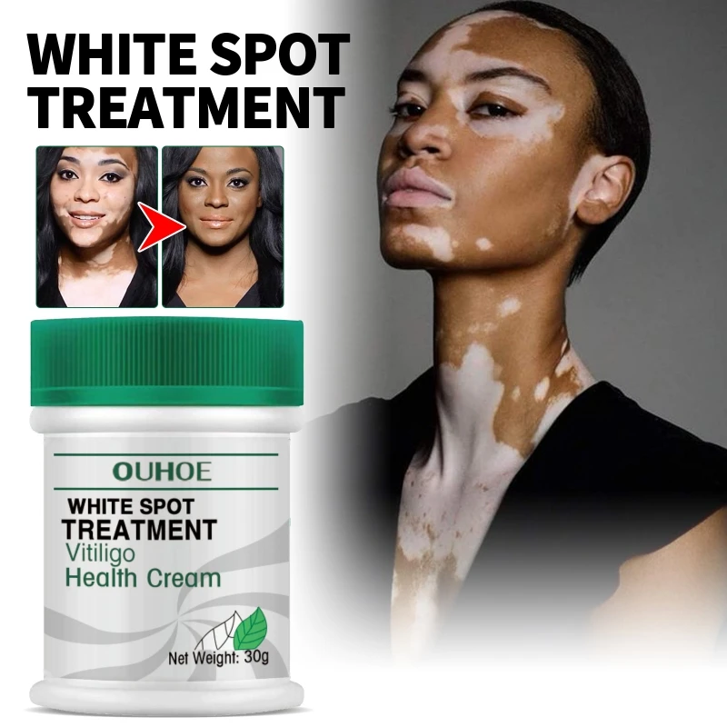 Efficient White Spot Remover Cream 30g Herbal Extract Skin Repair Cream Remove Pigment Repair Body Face Care Cre