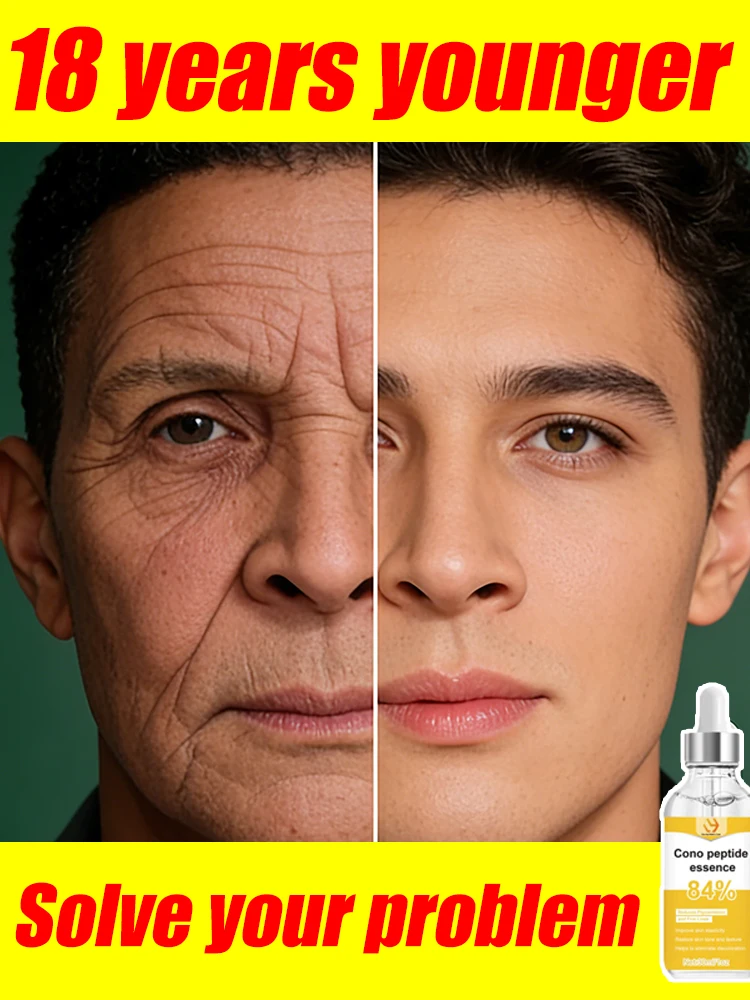 

Изменение уверенности и без морщин