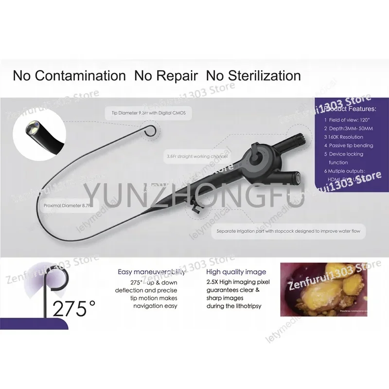 Urology Video Single Use Flexible Ureteroscope Disposable Ureteroscope Ureteroscope Urology Endoscope