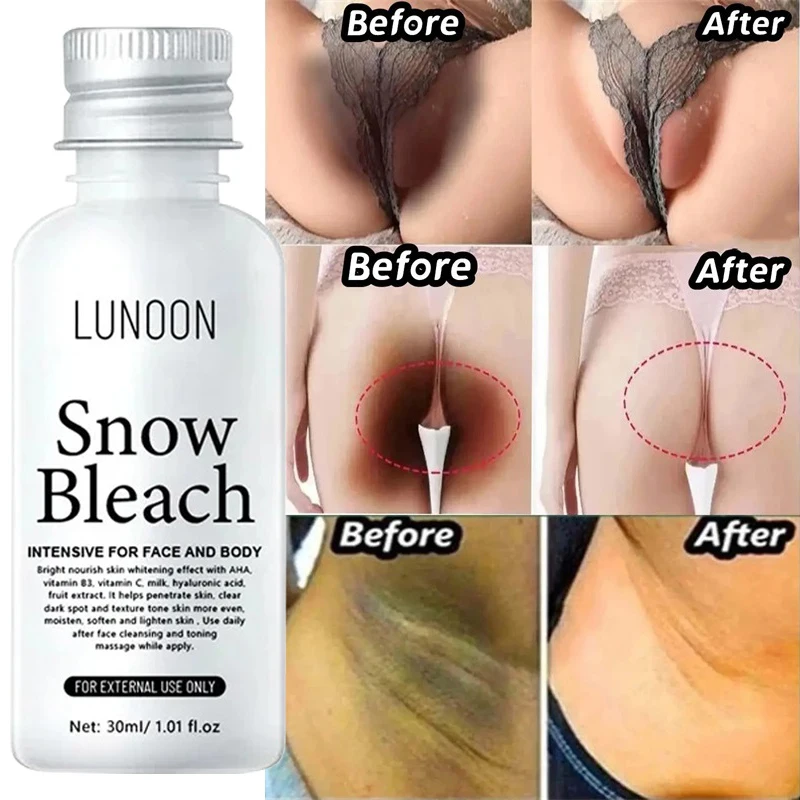 Whiten Cream Private Parts Underarm Bleaching Serum Whiten Butt Knee Brighten Lnner Thigh Intimate Parts Dark Remove Melanin New