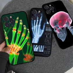 Radiologische menselijke organen skelet telefoonhoesje voor iPhone 15 8 7 6 6S Plus X SE 2020 XR XS 14 11 12 13 Mini Pro Max