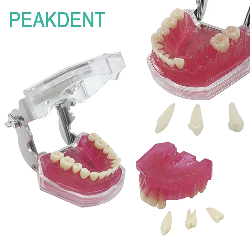 

Высококачественная съемная зуботехническая модель для обучения и демонстрации