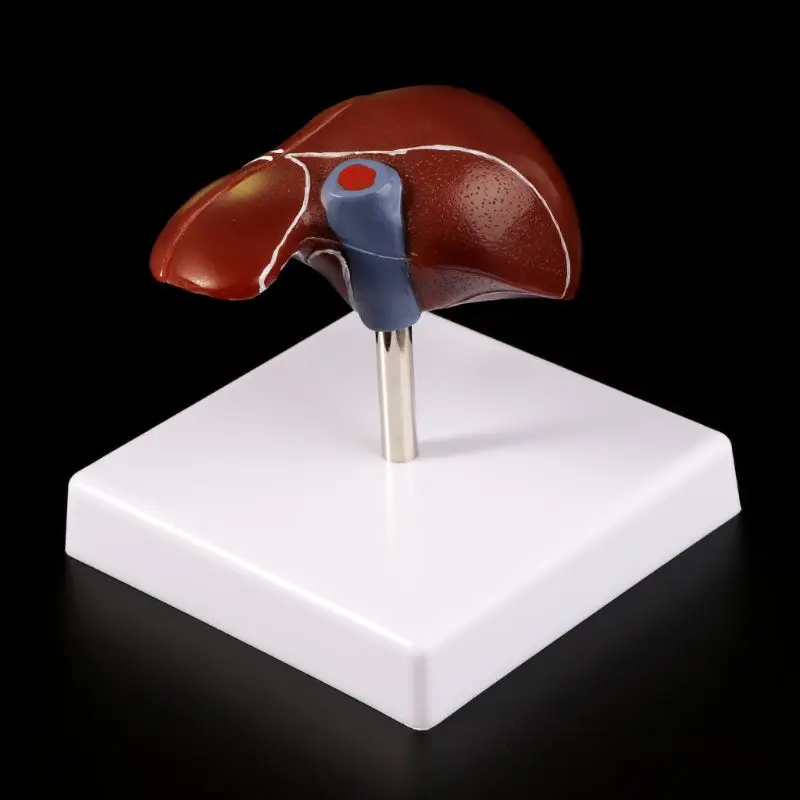 Human Liver Pathological Anatomical Model Anatomy School Medical Teaching Displa