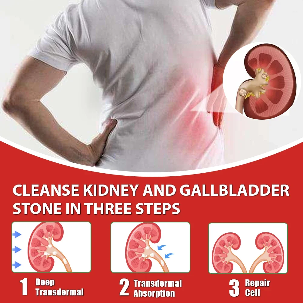 Sumifun 6pcs Kidney Care Patch Gallstones Treatment Plaster Back Pain Men Health Care Remove Kidney Stone Urolithiasis Plaster