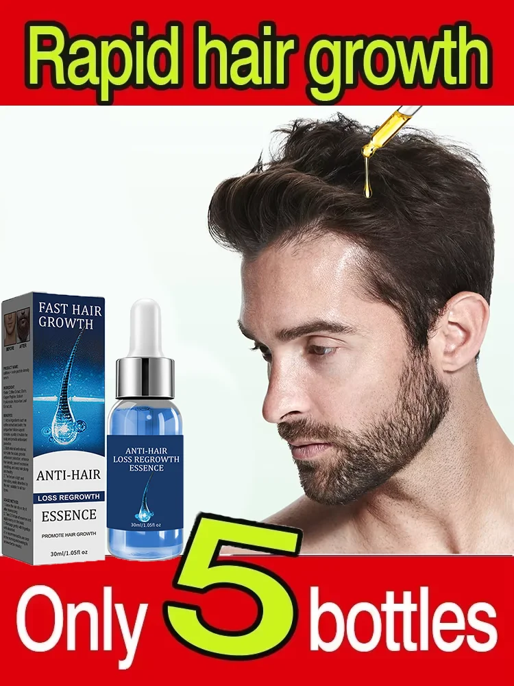 Hair Loss Treatment Spray Nourishing Regrowth Root Thicken Anti Fall Prevent Baldness Repair Damage Grow Hair Essence Spray