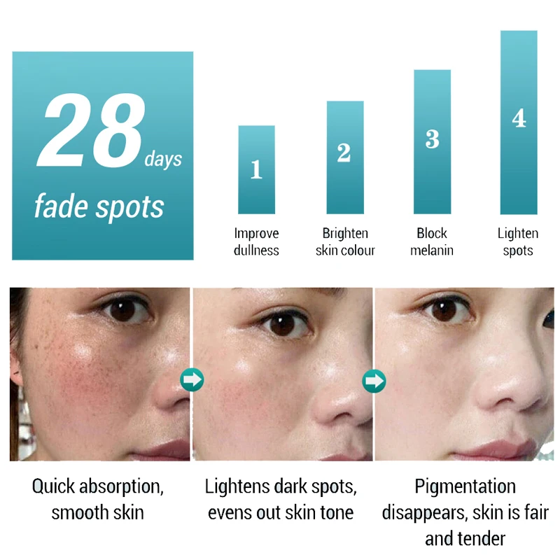 40g Face cream freckle removing cream is used to treat freckles on the cheeks, remove dark pigments,  keep the skin bright shiny