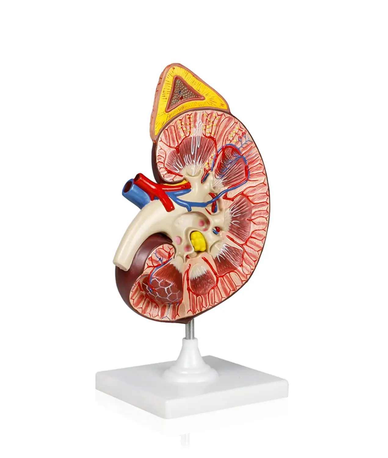 3X Life Size Kidney Model