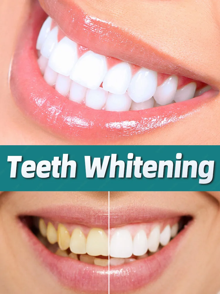 Teeth whitening Tooth Brighten TartarRemoval