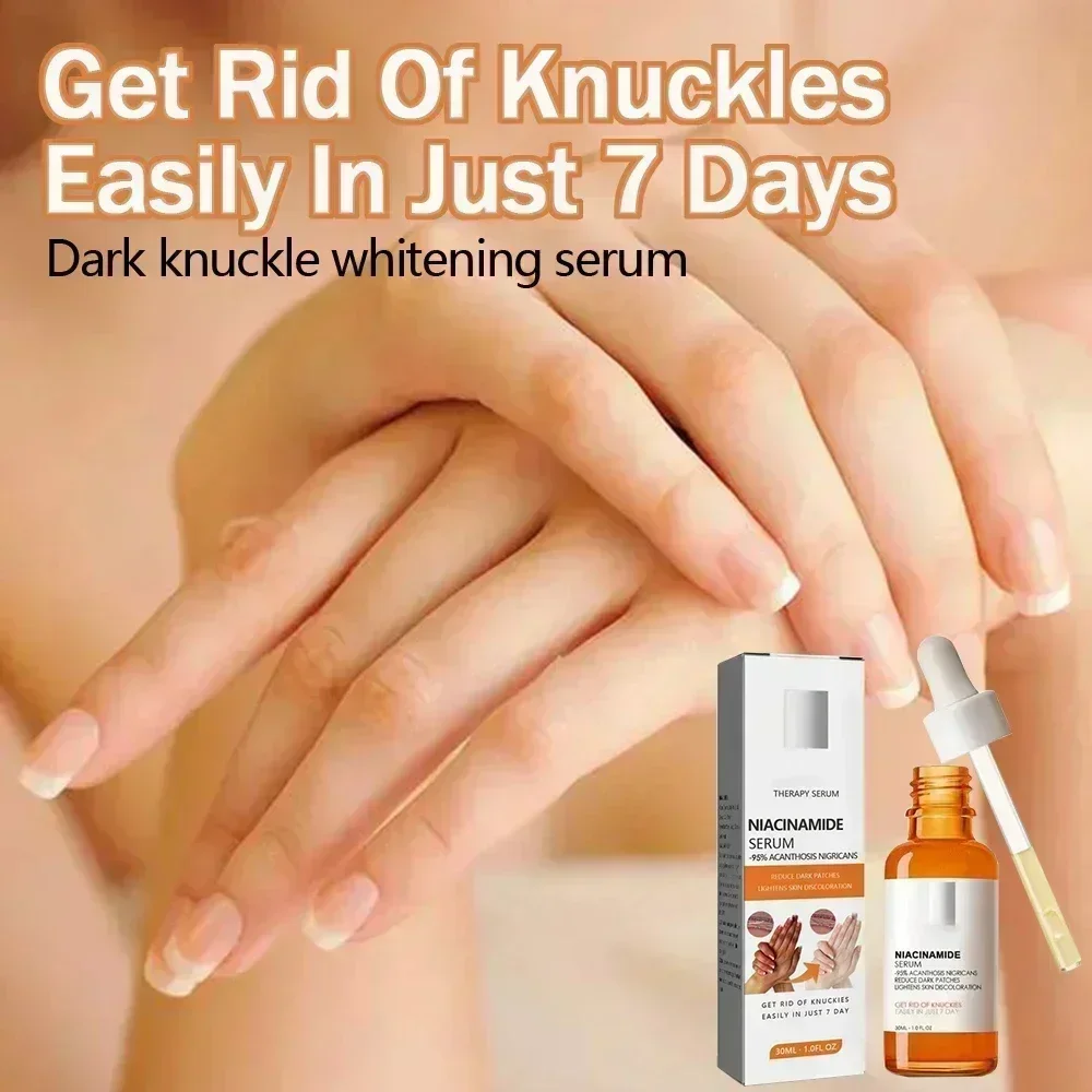 HOT~Dark knuckles whitening serum Elbows Armpit Beaching SerumWoman Private Part Skin Removal Dark Knuckles Strong Whitening Ser