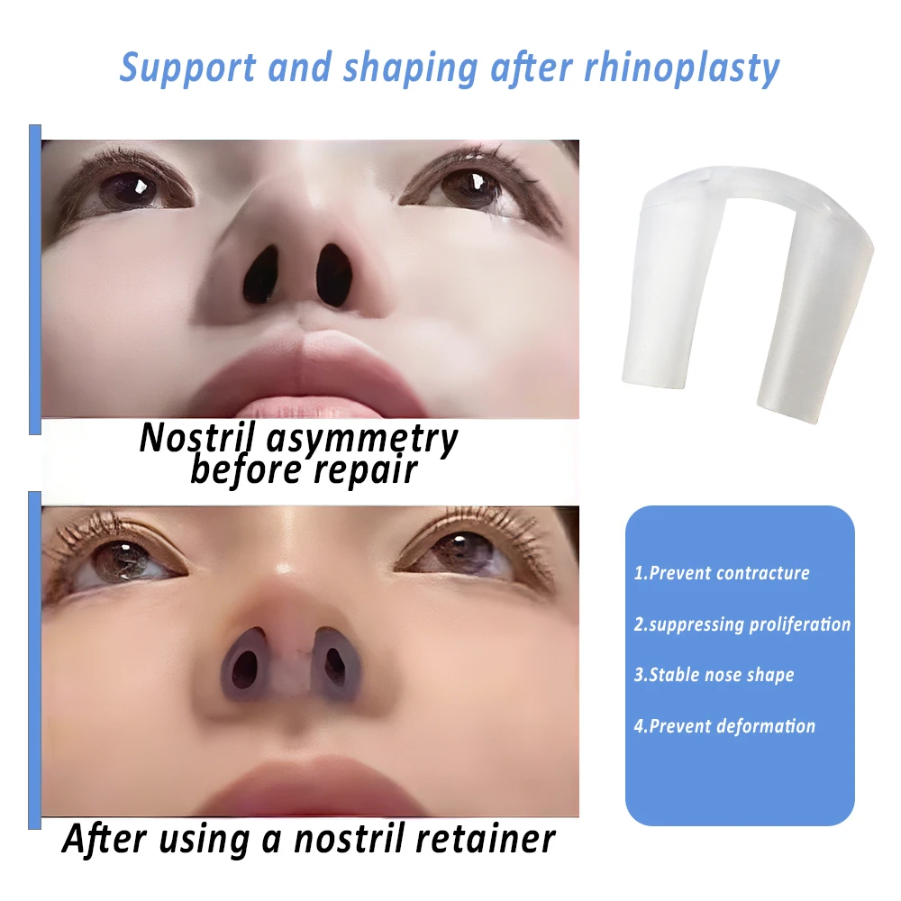 2/5Pcs Soft Silicone Nostril Retainer Post Rhinoplasty Nose Shaping Nose Splint Nose Surgery Recovery Support Device Household