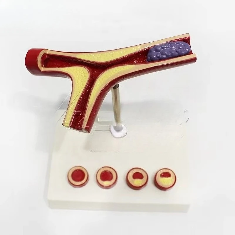 Cardiovascular model simulation teaching model, medical education