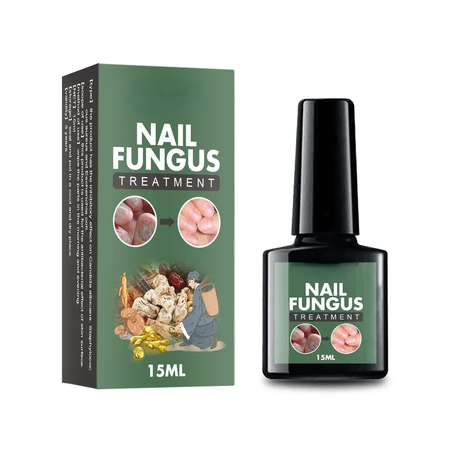 Nail Fungal Treatment Essence Oil Foot Toe Nail Fungus Removal Serum 7 Days Repair Onychomycosi Anti Infection Gel Care Products