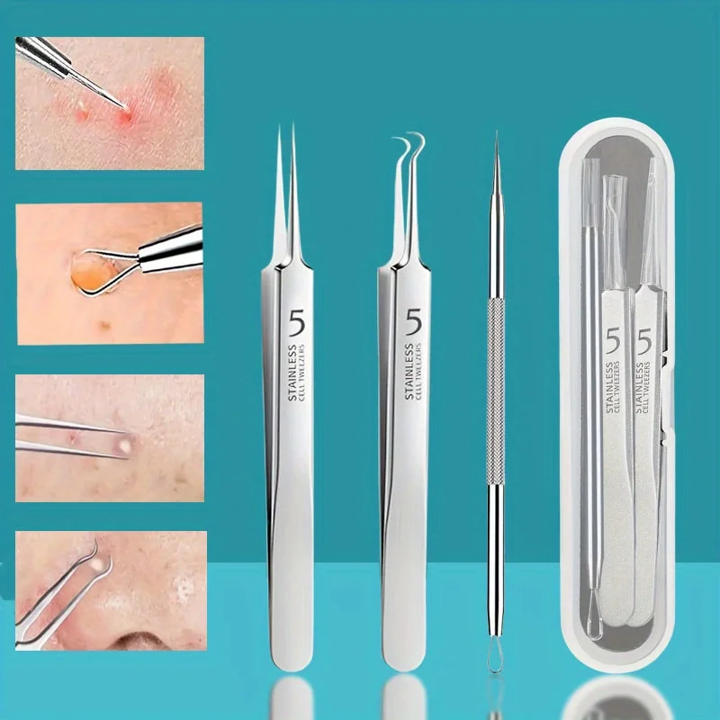 여드름 추출 도구, 블랙헤드 제거제, 여드름 푸퍼, 여드름 제거 키트 잡티에 대한 위험 없는 치료, 블랙헤드 핀셋