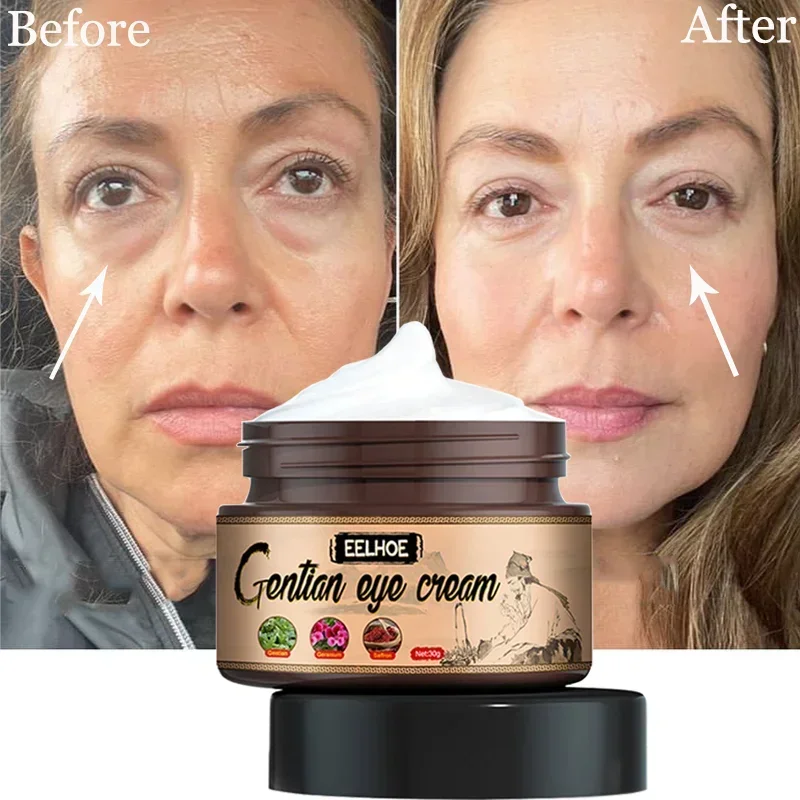 Fat Granules Eyes Cream Eye Bag Anti-Puffiness Moisturizing Remove Eyes Wrinkles Eye Care Dark Circles Removal Cream Firming