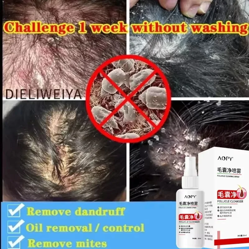 Hair Growth Oil Scalp Relief Supplement 20ml Quick Absorption Hydrating Hair Loss Relief Solution for Thinning and Damaged Hair