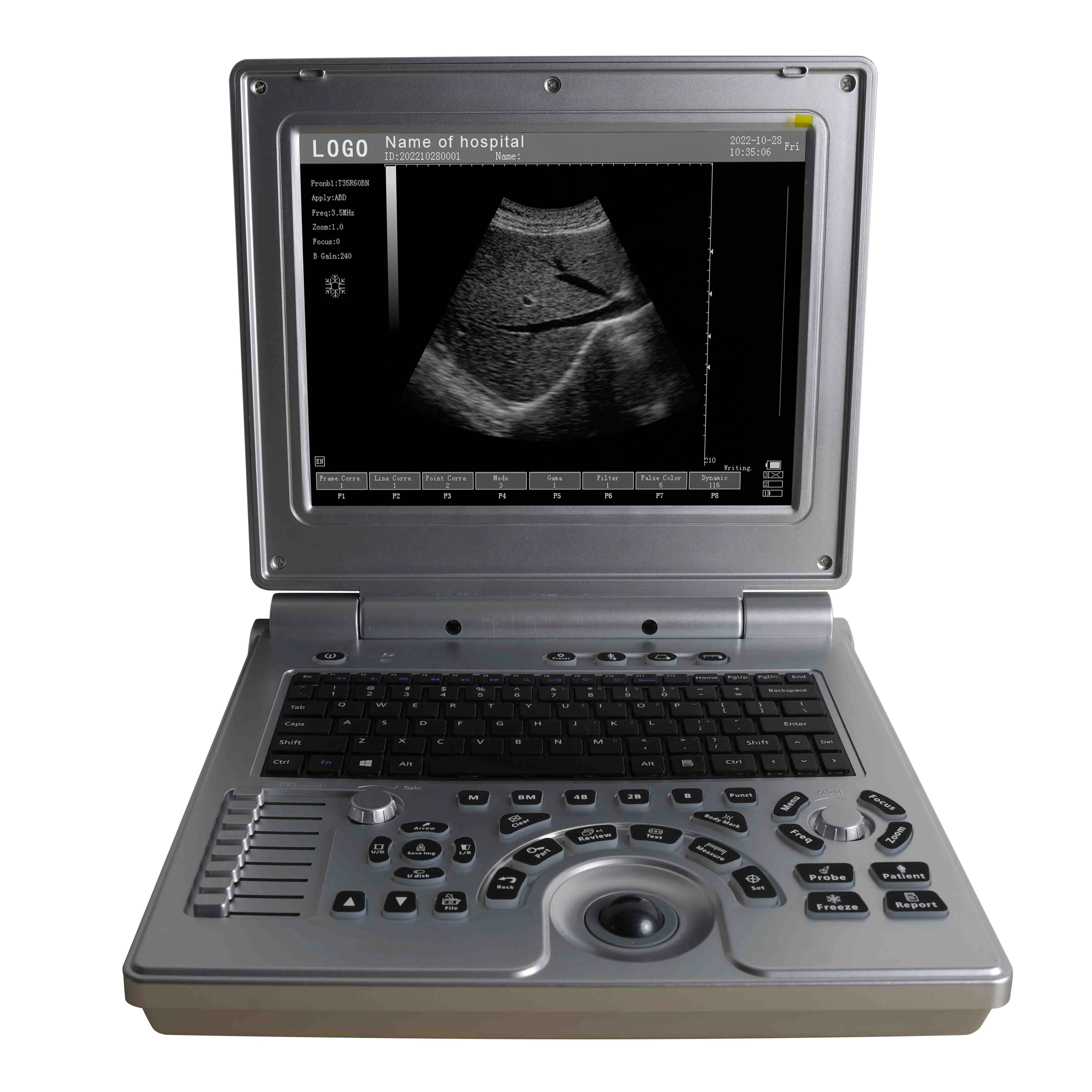 ARM Chip Architecture B/W Notebook Full Digital Portable Ultrasound Machine with Convex,Linear,TVS, Micro Convex, Rectal Scanner