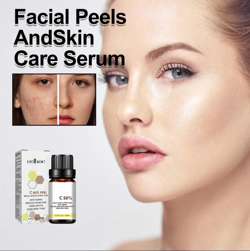 

7ht With Malic Acid Citric Acid For Face Facial Peel 50% Peeling Serum Peeling Serum Chemical Peel Whitening Nourishing Essence