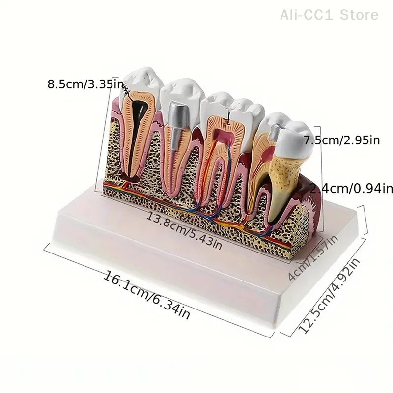 Standard Dental Oral Teeth Anatomical Teaching Model Comprehensive Tooth Structure Model Dentist Dental Student Demonstration