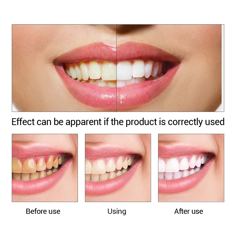 FTEENPLY Teeth Whitening Essence Powder Oral Hygiene Cleaning Serum Removes Plaque Stains Tooth Bleaching Dental Tools Care