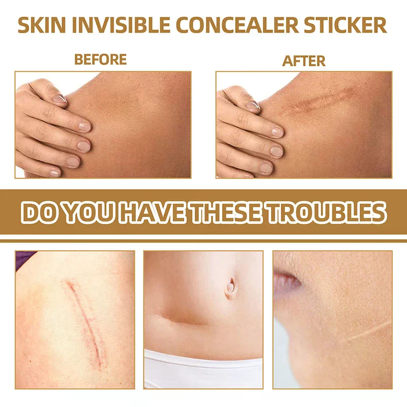 60Patch Waterproof Tattoo Flaw Conceal Tape Full Cover Concealer Sticker Body Arm Temporary Concealing Tattoo Scar Cover Sticker