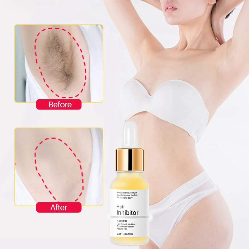 Essence d'Inhibition des Cheveux Perte Continue des Cheveux, Retenue Rapide, Aisselles, Jambes, Bras, Inhibiteur de Croissance, Soins de la Peau Coréens