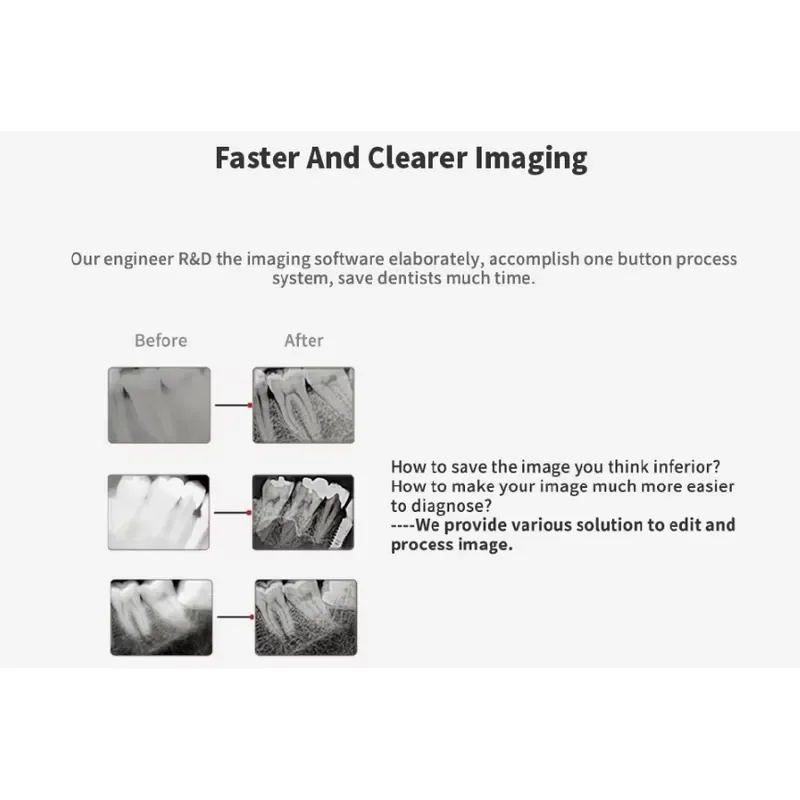 Handy HDR500 Xray Sensor Digital X-ray Digital Imaging System USB CMOS Digital Intraoral X-Ray Sensor