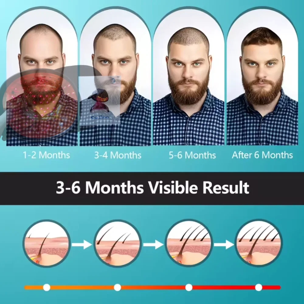 

Лазерная шапочка для роста волос для мужчин и женщин, устройство для шлема LLLT, против выпадения волос для истончения линии роста волос и истончения