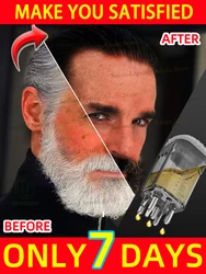 Anti gray hair, restores natural hair color, darkens hair from the root