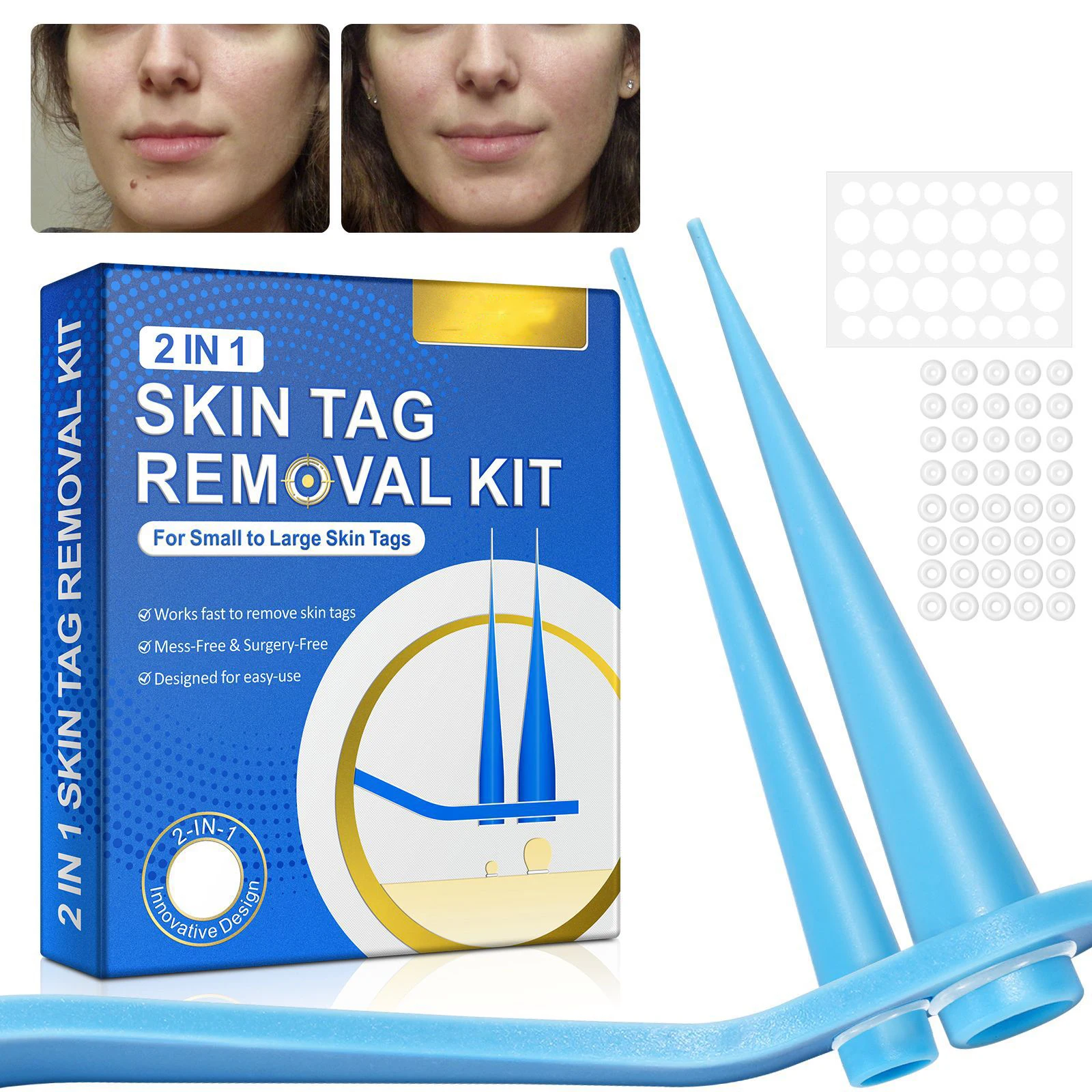 2 In 1 Auto Skin Tag Removal Kit Painless Mole Wart Remover Equipment Micro Skin Tag Treatment Tool Easy To Clean Skin Care Tool