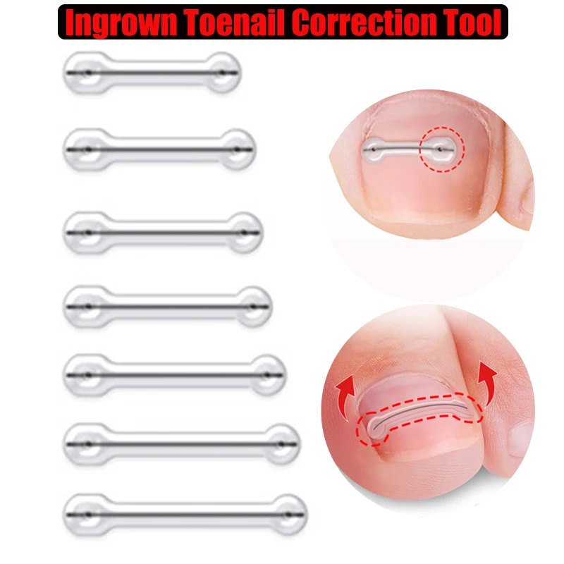 1Pcs Ingrown Toenail Correction Tool Embed Toe Nail Treatment Elastic Patch Sticker Straightening Clip Brace Pedicure Tools