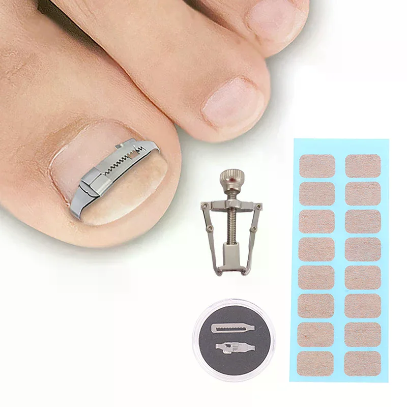 /JCS/Ingrown Toenail Corrector Tools Pedicure Recover Embed Toe Nail Treatment Professional Foot Care Correction Tool Care Foot