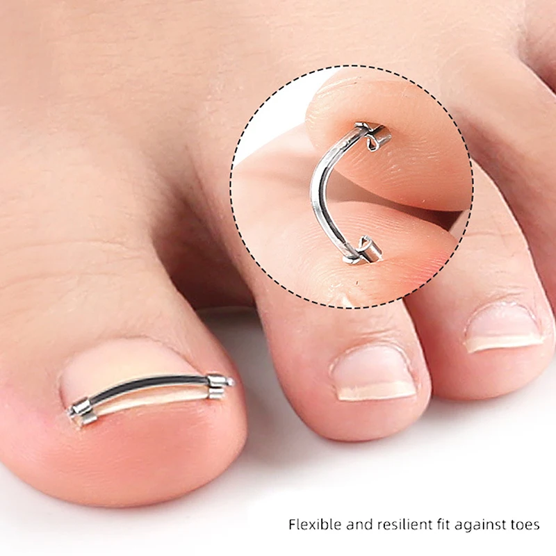 Pedicure Tool Embed Care Correction Ingrown Toenail Toe Nail Straightening Clip Curved Clamp Toenails for Toes