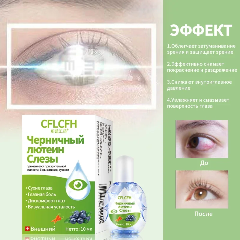 Eyesight Improvement Eye Drops 10ml Protect Vision Myopia Eyes Pain Dry Itchy Fatigue Blueberry Lutein Liquid Russian Language