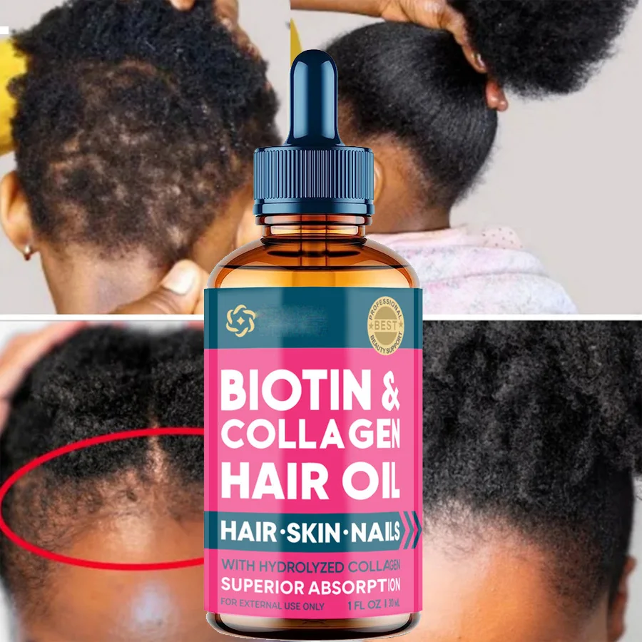 

Biotin Hair Care Nourish oil Hair Follicle Reduce Hair Loss Stabiliz Hair Root Refresh Oil Control Natural Plant Essence
