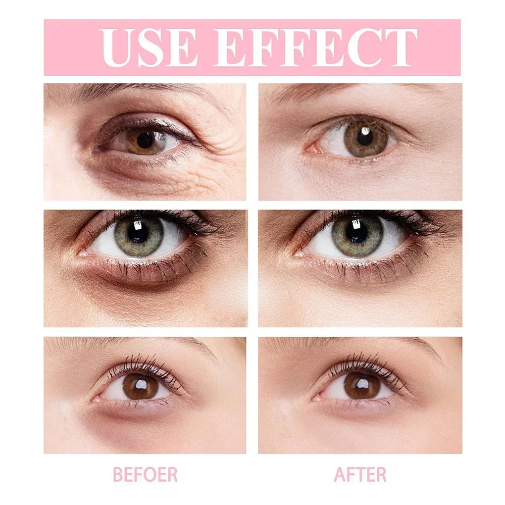 Instant Retinol Wrinkle Eye Cream, Anti bolsas nos olhos, Círculos escuros hidratantes, Reduzir Lightening, Linha Fina Stick