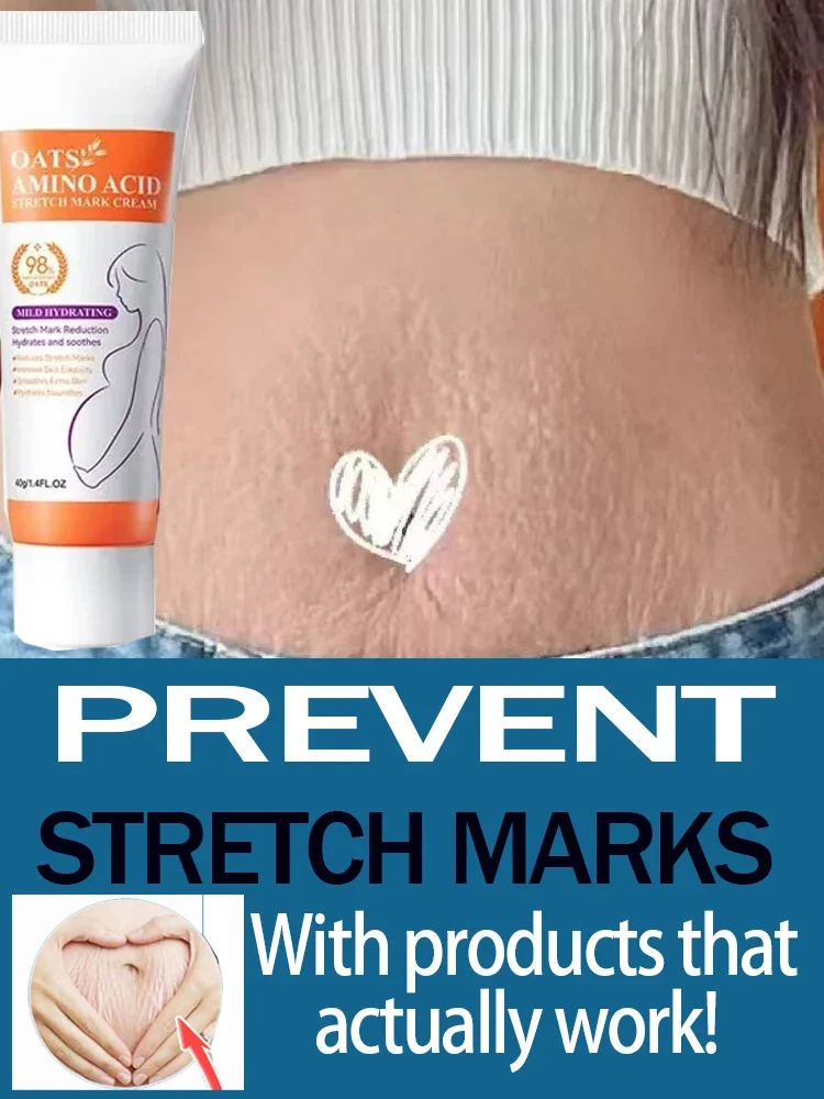 Stretch Marks Permanent Removal Cream Eliminate Body Belly Stretch Marks Swelling Marks Remove Skin Cracks Repair Firming Care