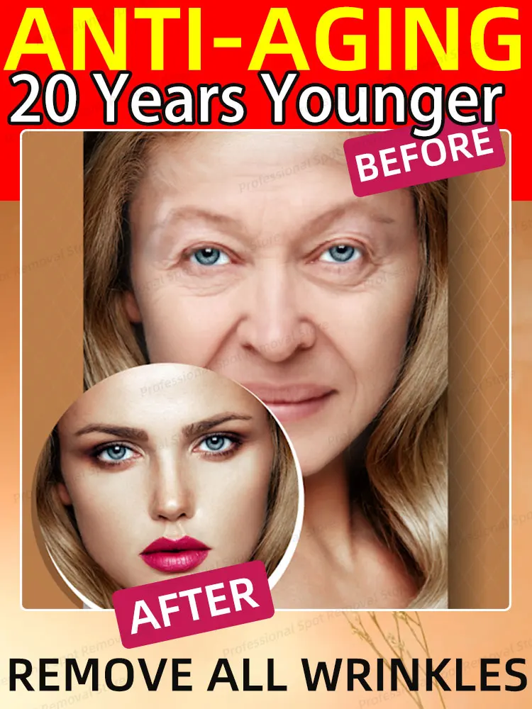 

20 years younger，wrinkles disappear