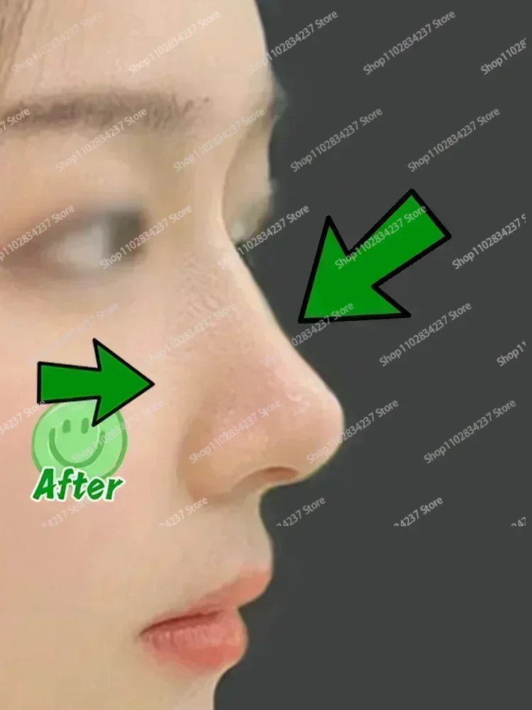 Caliente ~ nariz arriba aumentar aceite de esencia colágeno reafirmante Lifting hidratante hueso Nasal remodelación puro cuidado Natural de la nariz