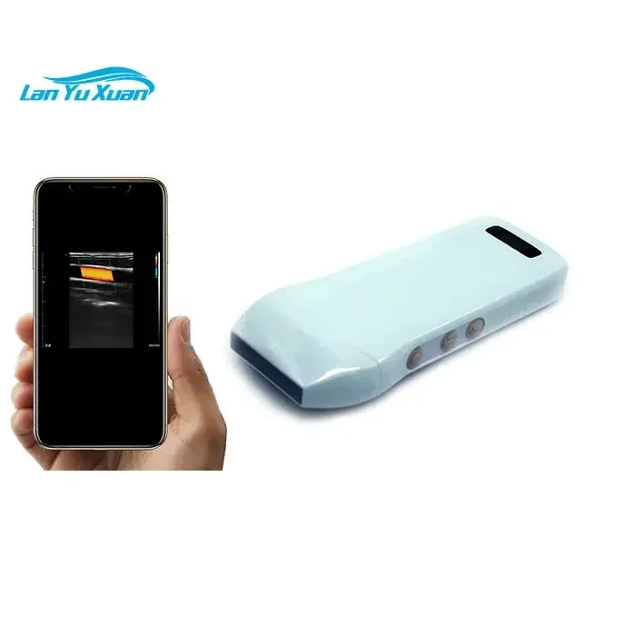

5G Wifi Channel Konted 192 Elements Wireless Ultrasound IPad Ultrasound Probe / Scanner