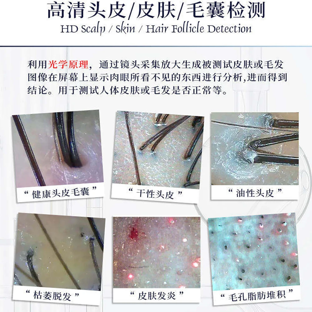 المهنية 5G واي فاي اللاسلكية المنزل استخدام فروة الرأس محلل الجلد المحمولة أربعة الطيف الكاشف