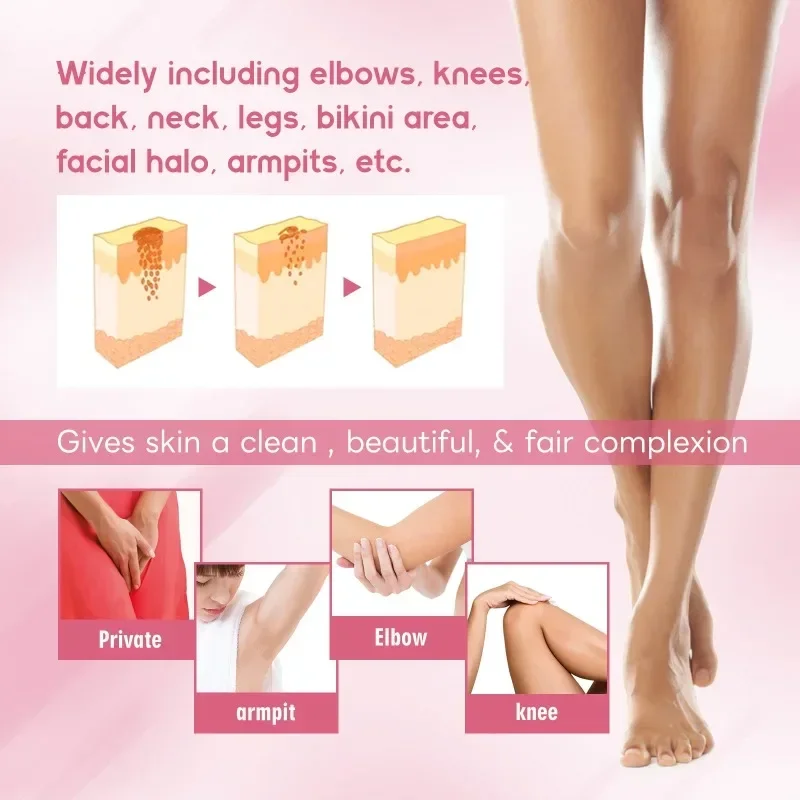 Intimate Firming cream Underarm Bleaching Whitening Private Parts Butt Knee Brighten Whiten Inner Thigh  Dark Remove Melanin