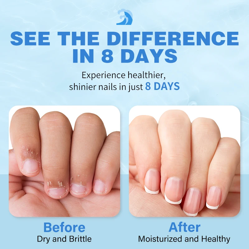 Óleo de cutícula para cutículas reparadas durante a noite - remédio para pele danificada e unhas finas - leite e mel